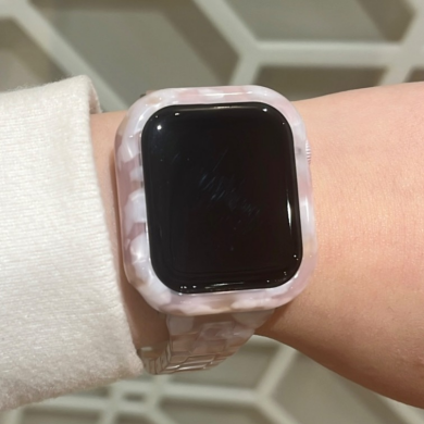 【AppleWatch】セットでかわいいウォッチアクセサリーのご紹介!